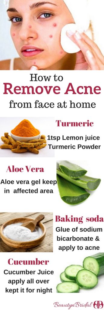 Overnight acne to home remove how at 