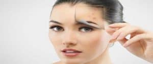 Types of acne on face