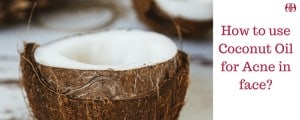 How To Use Coconut Oil For Acne