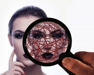 facial fillers