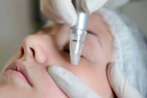 phenomenon of Dr Pen USA Microneedling Pen