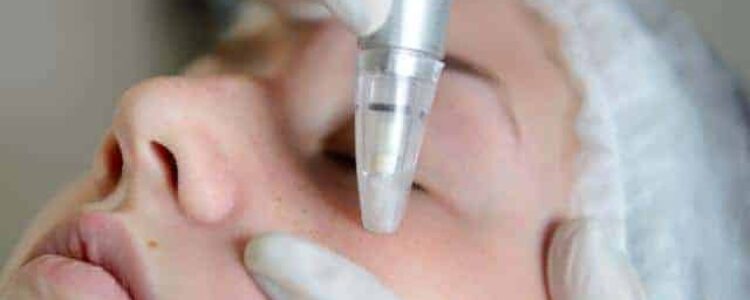 What is the phenomenon of Dr Pen USA Microneedling Pen?